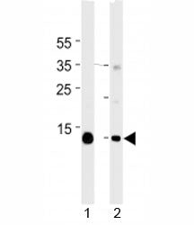 Myoglobin Antibody