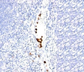 Granulocyte Antibody