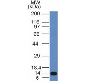 Western blot analysis of a recombinant protein fragment of ALK using Anaplastic Lymphoma Kinase anti