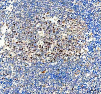 IHC staining of FFPE human tonsil tissue with BAG1 antibody. HIER: boil tissue sections in pH8 EDTA 
