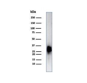 Calbindin 2 Antibody / CALB2 / Calretinin