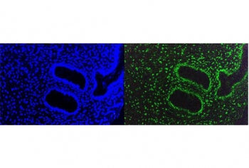 TRIM28 Antibody / KAP1