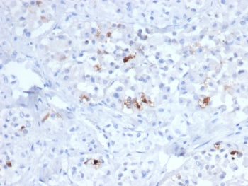 FSH-beta Antibody