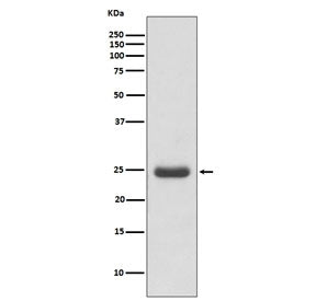 TK1 Antibody / Thymidine Kinase 1
