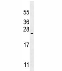 VEGF-A antibody western blot analysis in K562 lysate. Expected molecular weight 19~22 kDa (monomer) 