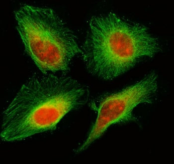 Immunofluorescent staining of FFPE human HeLa cells with MIS18A antibody (red) and Beta Tubulin mAb 