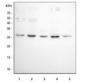 Western blot testing of 1) human MCF7, 2) human PC-3, 3) human HeLa, 4) human SiHa and 5) rat heart 