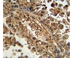 ABCG1 Antibody
