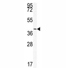 SIRT6 Antibody