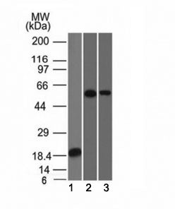 Western blot analysis of 1) recombinant partial protein, 2) A549 and 3) A431 stained with TOX-3 anti