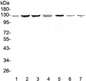 SMC6 Antibody