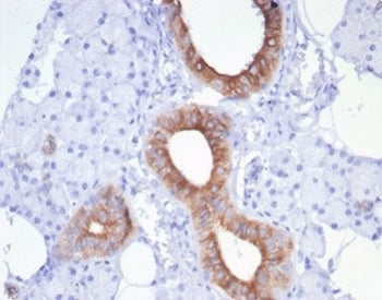 IHC staining of FFPE human salivary gland tissue with recombinant CFTR antibody (clone rCFTR/7175) a