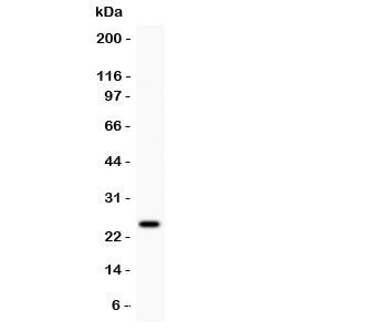Prolactin Antibody