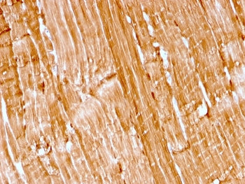 Myoglobin Antibody