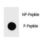 PTEN Antibody (phospho-Y336)