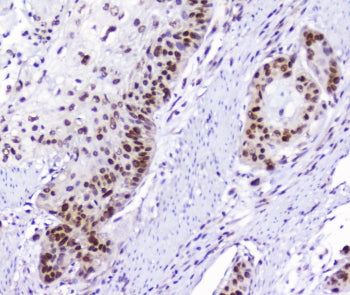 Aryl Hydrocarbon Receptor Antibody / AHR