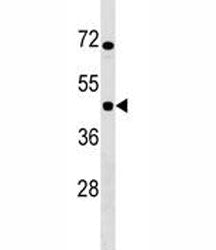 IKBIP antibody western blot analysis in Jurkat lysate.