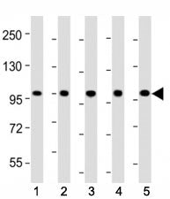 Western blot testing of LGR-5 antibody at 1:2000 dilution. Lane 1: mouse skeletal muscle; 2: rat ske