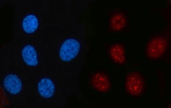 Immunofluorescent staining of FFPE human PC-3 cells with RFC2 antibody (red) and DAPI nuclear stain 