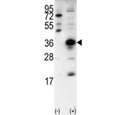 Western blot analysis of SNAI1 antibody and 293 cell lysate (2 ug/lane) either nontransfected (Lane 