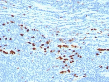 IHC analysis of formalin-fixed, paraffin-embedded human tonsil stained with MRP14 protein antibody (