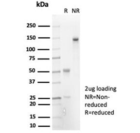 SDS-PAGE analysis of purified, BSA-free recombinant IL-7 antibody (clone IL7/7053R) as confirmation 