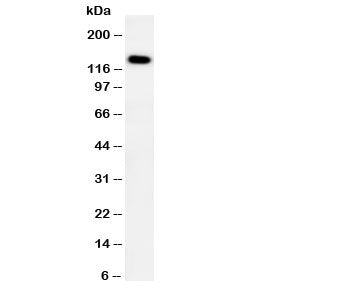 PTCH2 Antibody (Patched 2)