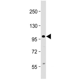CIP2A Antibody / p90 Autoantigen / KIAA1524 (Center Region)