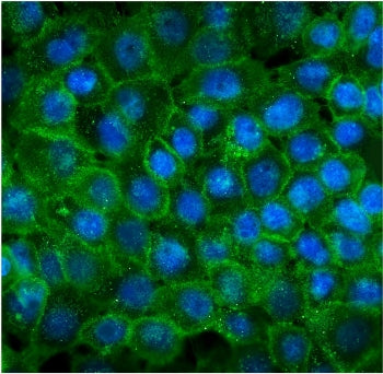 P-Cadherin Antibody / CDH3