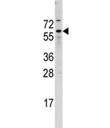 CDC25B Antibody