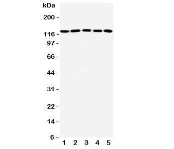 Western blot testing of ST5 antibody and Lane 1: rat testis; 2: human A431; 3: (h) HeLa; 4: (h) COLO