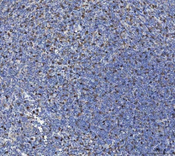Interleukin 10 Antibody / IL-10