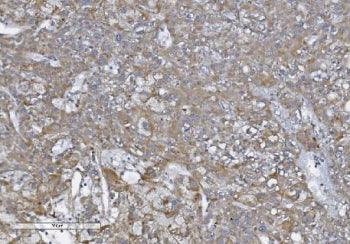 NOD1 Antibody