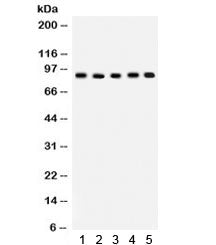 Western blot testing of 1) rat spleen, 2) rat lung, 3) rat thymus, 4) mouse lung, 5) human SW620 lys