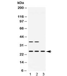 Western blot testing of 1) rat brain, 2) mouse brain and 3) human HeLa lysate with HPRT antibody at 
