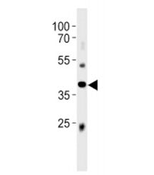 Abi3 Antibody