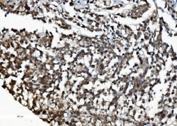 DDX1 Antibody