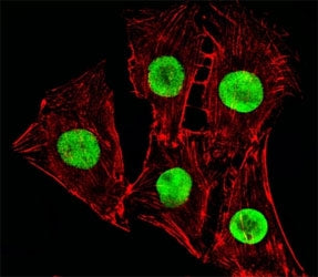 Hmga2 Antibody