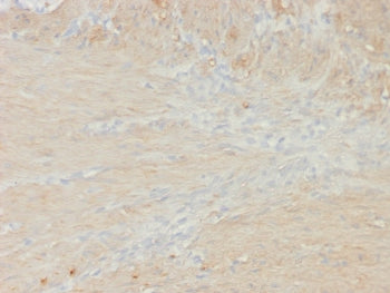 IHC staining of FFPE colon smooth muscle tissue with recombinant MYH11 antibody (clone rMYH11/8066).