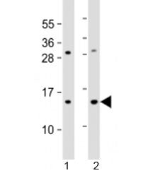 Western blot testing of 1) human HL-60 and 2) mouse Neuro-2a cell lysate with EIF1 antibody at 1:200