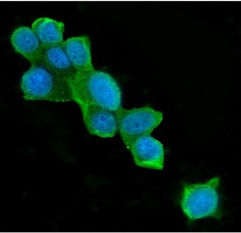 ATP Citrate Lyase Antibody