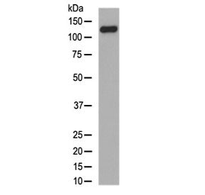 Collagen XVII Antibody / COL17A1