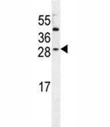 IGF2 Antibody