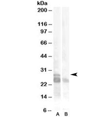MYF5 Antibody