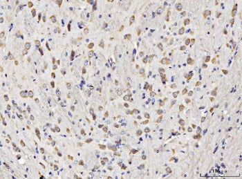 IHC staining of FFPE mouse brain tissue with RPL11 antibody. HIER: boil tissue sections in pH8 EDTA 