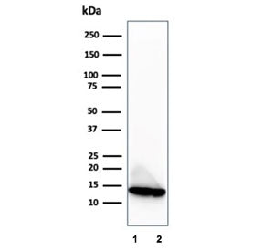 Western blot testing of human 1) LNCaP and 2) PC3 cell lysates using Macrophage migration inhibitory