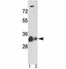 VDAC1 Antibody