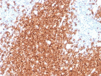 IHC staining of FFPE human spleen with recombinant CD22 antibody (clone rBLCAM/4108). HIER: boil tis