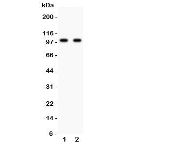 GLUR4 Antibody (Glutamate Receptor 4)