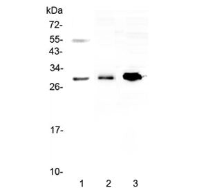 VEGFB Antibody / VEGF2